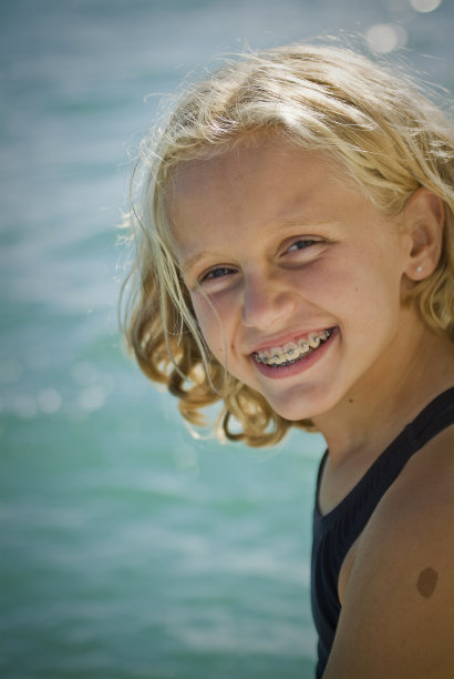 金发女孩带着支架对着镜头微笑图片下载