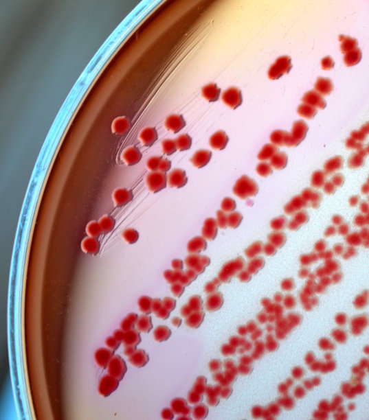 大肠杆菌图片下载