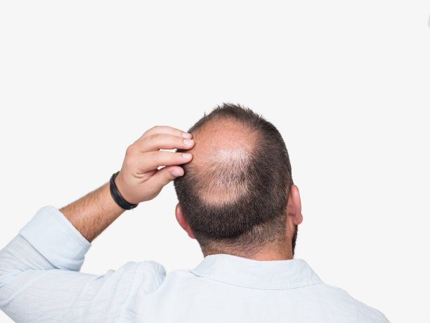 光头青年，后视镜图片下载