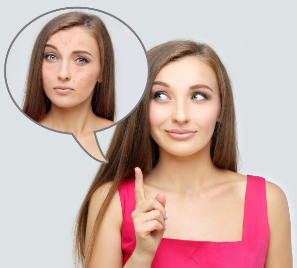 酒渣鼻。有问题的女孩和干净的皮肤。图片下载