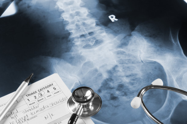 听诊器下的x光底片，笔记和笔图片下载