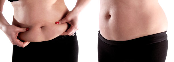 腹部脂肪图片下载