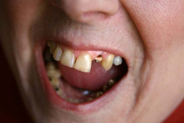 啊!张开嘴看牙医!女人缺牙图片下载