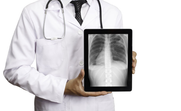 医生手持平板电脑，屏幕上显示“肺部x光”图片下载