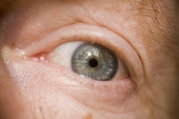 激光手术后关闭灰色虹膜和眼睛图片下载