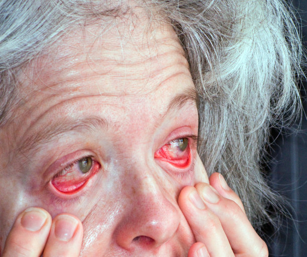 粉红色的眼睛图片下载