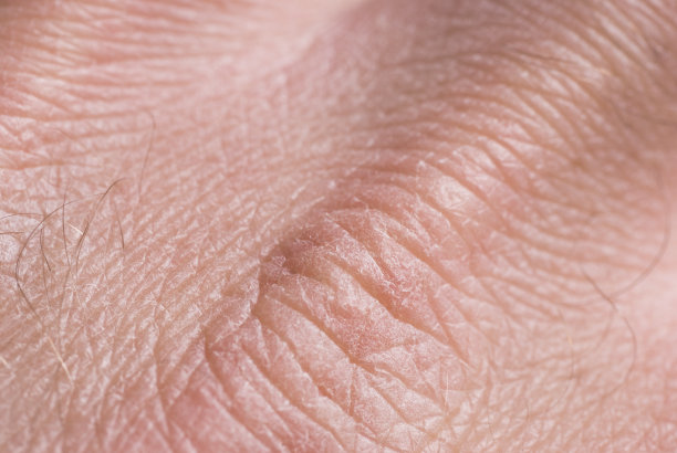 干燥的皮肤图片下载