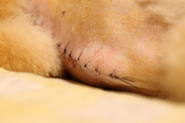 手术后图片下载