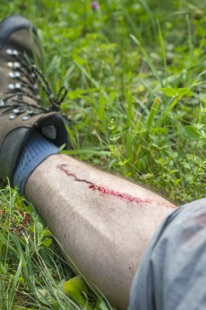 徒步旅行的腿受伤图片下载