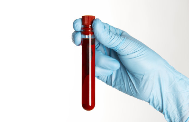 试管照片素材ID：153442786