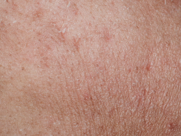 皮肤纹理干燥图片下载