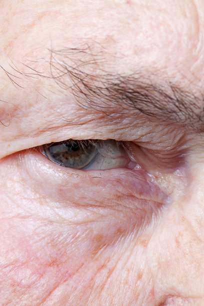 关闭眼睛图片下载