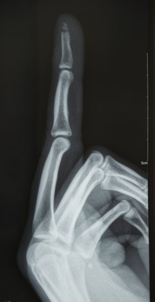 x光片显示中指征图片下载