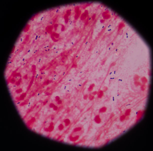 革兰氏染色法,图片下载