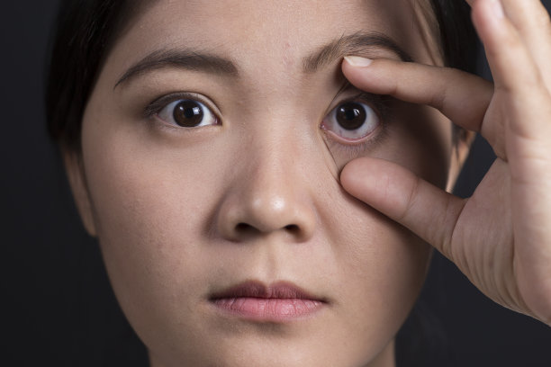 女人眼睛疼图片下载