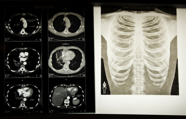 X光图像图片下载