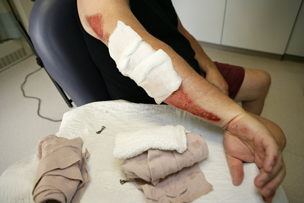 路皮疹图片下载