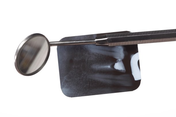 牙科x光片细节及仪器图片下载