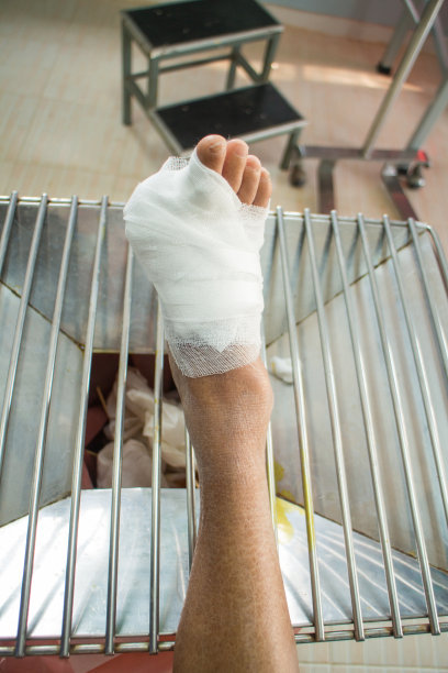 糖尿病溃疡图片下载