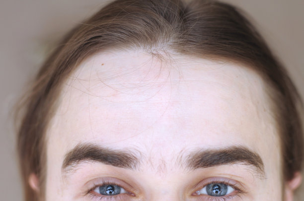 额头的男人图片下载