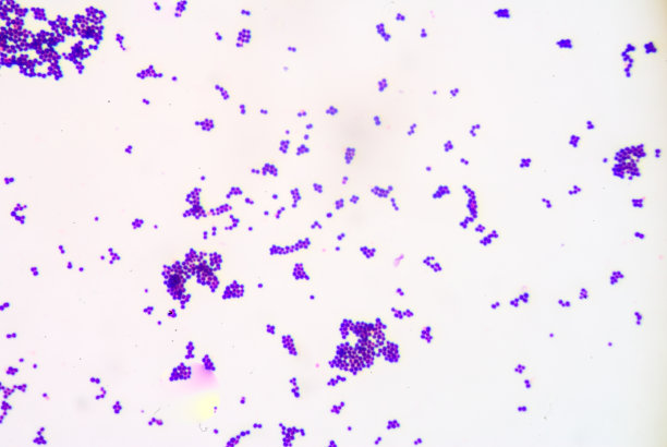 革兰氏染色，革兰氏阳性球菌。图片下载