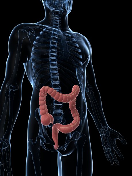 男性结肠癌图片下载