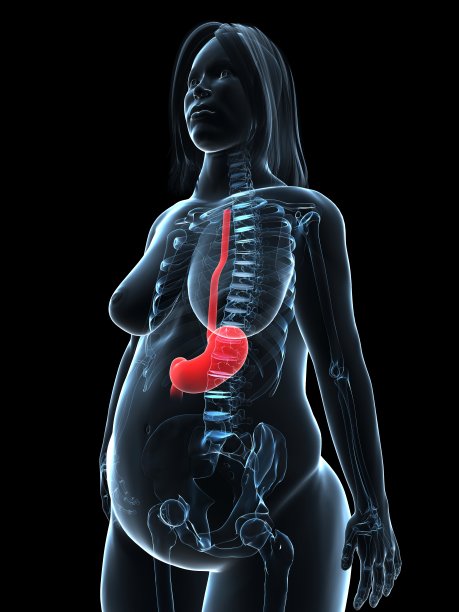 超重女性-胃图片下载