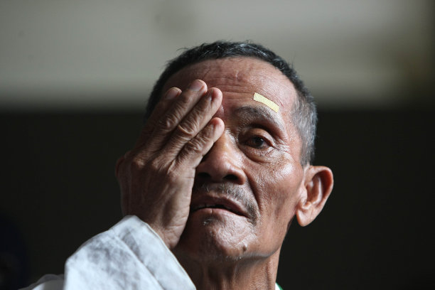 白内障手术图片下载