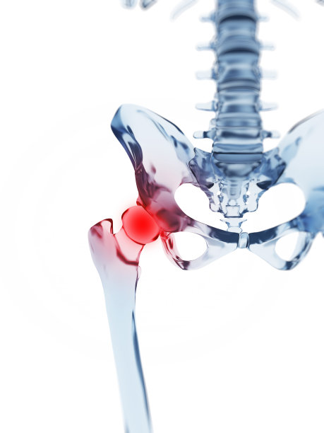 髋关节疼痛图片下载