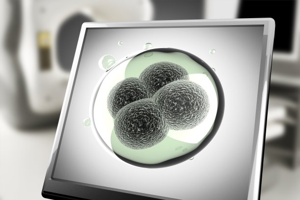 单微单元监控图片下载