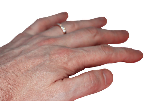 白种人的手长着白种人的手指图片下载