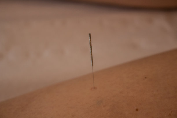 针灸针图片下载