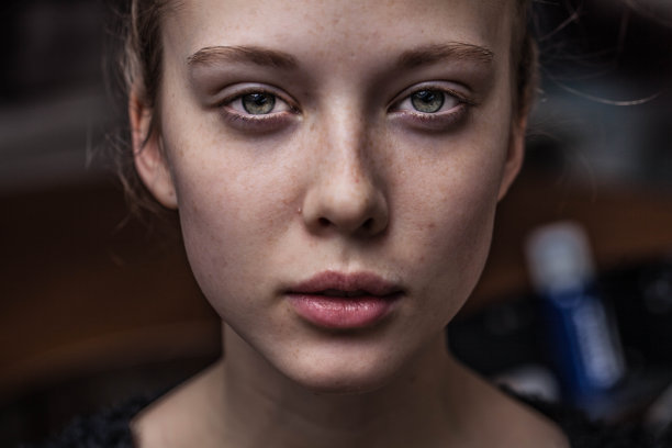 长着雀斑的漂亮女孩图片下载