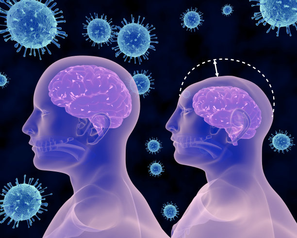 寨卡病毒和小头症图片下载