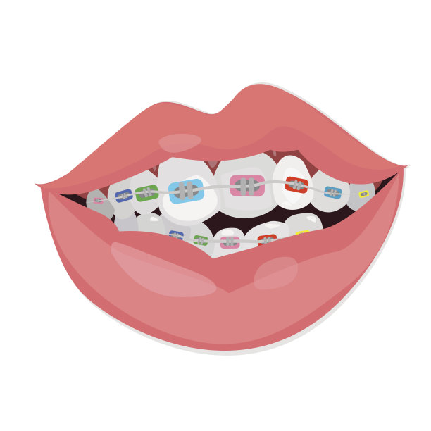 牙齿牙套。矢量图图片下载