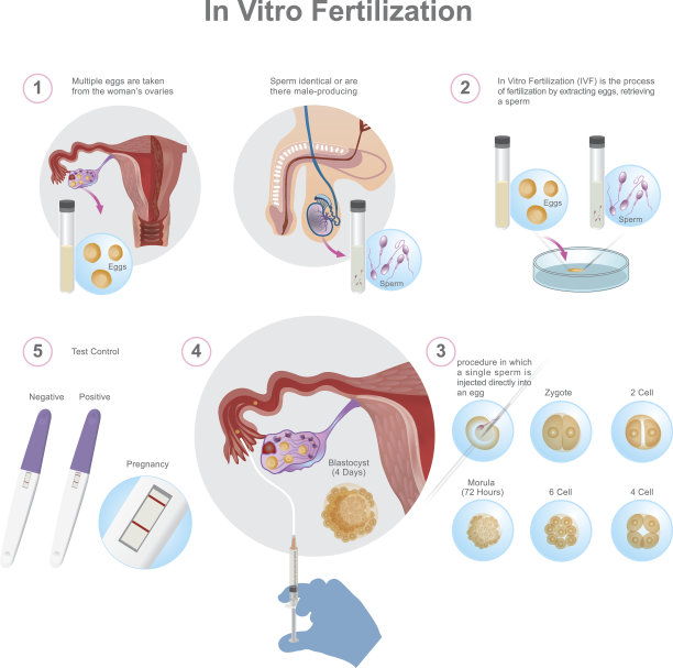 体外受精(IVF)图片下载