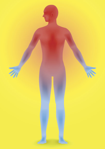 人体中暑，发热，热瘫，图像说明素材图片