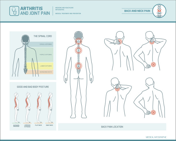 背部疼痛信息图表素材图片