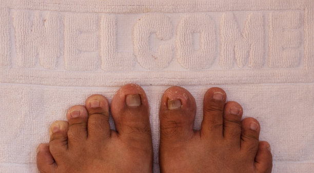 干燥粗糙的脚图片下载