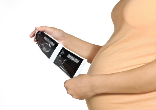 孕妇在看超声波图片下载