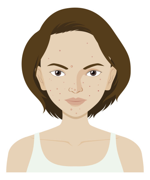 女人脸上长着青春痘图片下载