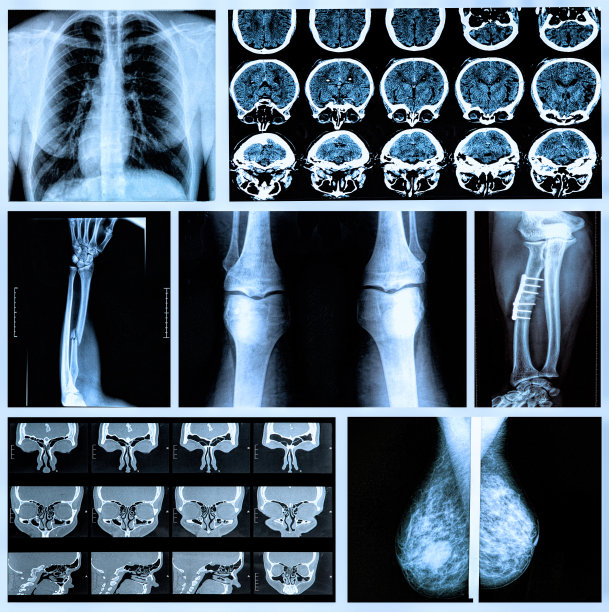 人的骨头图片下载