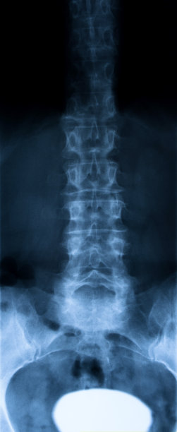 女性脊椎图片下载