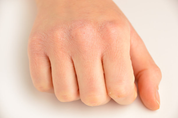 皮肤干燥的手图片下载