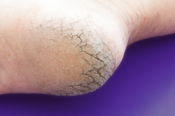 裂缝在高跟鞋图片下载