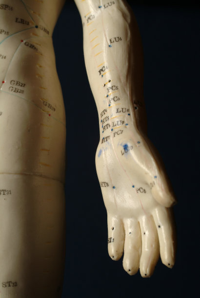 针灸(手和手臂)图片下载