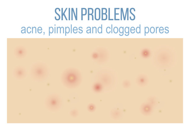 问题皮肤的俯视图素材图片