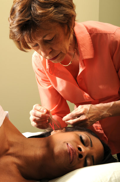 针灸师在工作图片下载