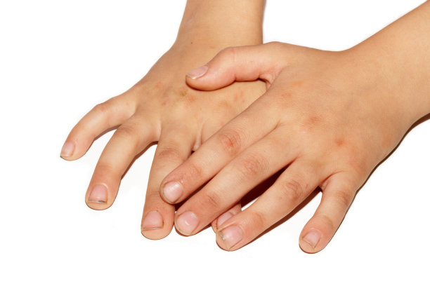 孩子的脏手图片下载