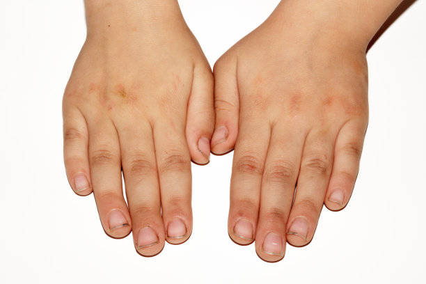 孩子的脏手图片下载